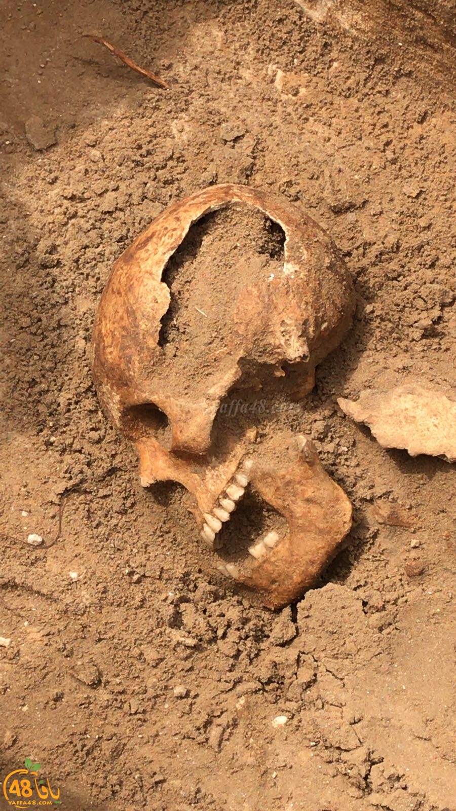 WhatsApp Image 2020-06-17 at 9.30.53 AM (1).jpeg.jpg.jpg